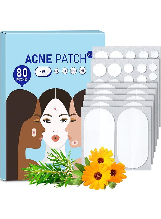 general Large Acne Pimple Patches, 5 Sizes 80 Patches for Large Breakouts, Acne Patches for Face, Chin or Body, Acne Spot Patch with Tea Tree & Calendula Oil, Hydrocolloid Bandages for Acne Skin - Image 1